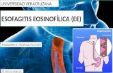 Esofagitis eosinofílica
