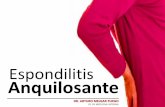 Espondilitis Aquilosante