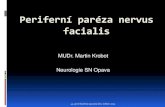 Periferní paréza nervus facialis