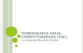 Tomografia axial computarizada (TAC), TOMOGRAFIA COMPUTARIZADA HELICOIDAL, CUADRO HEMATICO.