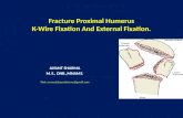 Fracture proximal humerus
