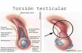 Torsion testicular