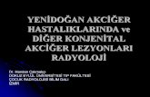 Yenidoğan Akciğer Hastalıklarında ve Diğer Konjenital Akciğer ...