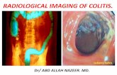 Presentation1, radiological imaging of colitis.