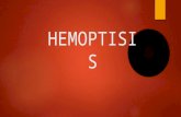 Fbb hemoptisis