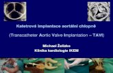 Katetrová implantace aortální chlopně (Transcatheter Aortic Valve ...