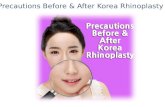 Precautions before & after korea rhinoplasty