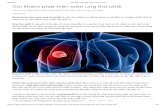 Tầm soát ung thư phổi - trungtamungbuou.com