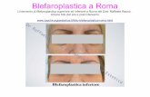 Blefaroplastica a Roma | Chirurgo Plastico Raffaele Rauso