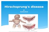 Hirschsprung's disease