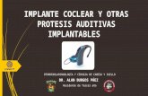 Implante coclear