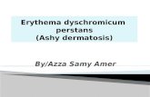 Ashy dermatosis