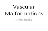 Vascular malformations