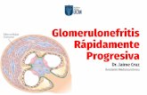 Glomerulonefritis Rápidamente Progresiva