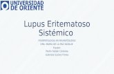 Lupus eritematoso-sistémico-gsf