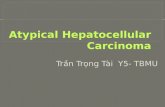 Atypical hepatocellular carcinoma