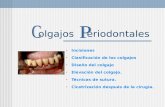 Colgajos periodontales