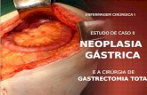GASTRECTOMIA - Enfermagem Cirúrgica - Estudo de Caso