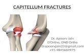 Capitellum fractures