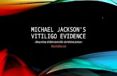 Michael jackson’s vitiligo - Bằng chứng về bệnh bạch biến của Michael Jackson