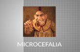 microcefalia resumen