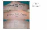 Tatoo removal rimozione tatuaggi