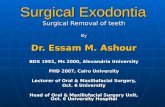 Surgical exodontia