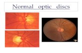 Normal optic discs. בעיות כליד פפילאדמה  בצקת של עצב הראייה.
