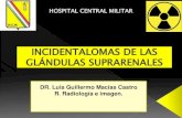 INCIDENTALOMAS DE LAS GLÁNDULAS SUPRARRENALES (ADRENALES)