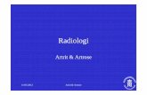 Artrit og Artrose - mrprofessor.dk og Artrose.pdf · 11-03-2012 Artrit & Artrose Artrose 1. Rodled 2. Heberden’s knuder 3. Buchards knuder Osteoartrose – 86 årig kvinde