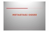 METASTASI OSSEE - med.unipg.it Didattico/Diagnostica per Immagini e... · metastasi ossee Radioterapia • Effetto citocida sulle cellule neoplastiche con riduzione dei fenomeni meccanici