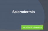 Sclerodermia - umfiasi.ro de Medicina... · Hiperplazia aparatului juxtaglomerular ... Fenomen Raynaud renal hTA (infectii, droguri, ... Terapia ameliorează simptomele şi funcţia