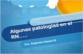 Patología poco grave, muy -  · PDF filePatología poco grave, muy frecuente Obstrucción de vía lagrimal Conjuntivitis neonatal