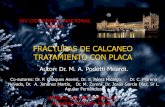 FRACTURAS DE CALCANEO TRATAMIENTO CON PLACAsetla.org/wp-content/uploads/Fracturas-de-Calcaneo.-Tratamiento... · a su trabajo habitual. •El 40% de pacientes fueron dados de alta