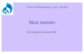 Skin tumors - Kezdőoldal -  · PDF fileEpidermal tumors In situ cc. : Morbus Bowen, ... T cell cutan lymphoma, Mycosis fungoides ... Lentigo maligna melanoma