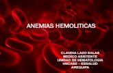 ANEMIAS HEMOLITICAS - sph-peru.orgsph-peru.org/wp-content/uploads/2016/01/ANEMIA-HEMOLITICA-CUR… · Anemia por disminución de supervivencia del ... CRISIS MEGALOBLASTICA . LABORATORIO