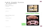 Lab 6. Limbic System &  · PDF fileMedical Neuroscience 7- Lab 6. Limbic System & Ventricles Lesion Lessons Lesion 7.1. Moe Bedder i) Location: ii) Signs/symptoms: iii) Cause: