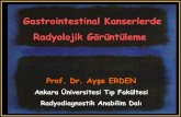 Gastrointestinal Kanserlerdekanser.org/saglik/upload/21_05_13/3.kongre... ·  · 2013-05-21Gastrointestinal Kanserlerde Radyolojik Görüntüleme Prof. Dr. Ayşe ERDEN Ankara Üniversitesi