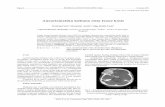 Aneurizmatska koštana cista čeone kosti - doiserbia.nb.rs · zija. Delimično pregrađenu šupljinu ciste ispunjavala je ... cept, controversy, clinical presentation, and imaging.