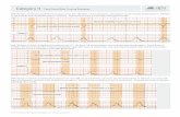 Category II Fetal Heart Rate Tracing Examples - … Heart Rate Tracing Examples www .aps-web.c om for 30 seconds and immediate return to baseline. Contractions every 2–4 minutes,