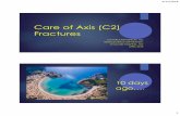 Care of Atlas (C2) Fractures - centracare.com · Commonly associated with C1 fx ... Posterior atlas and axis screw-rod fixation and fusion. ... 4/12/2018 11 Posterior atlas and axis