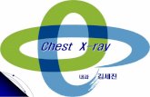 Chest X-ray - kuh.co.kr X-ray_내과전공의 김세진... · Check the Heart Size Shape Silhouette-margins should be sharp Diameter (>1/2 thoracic diameter is enlarged heart) Remember: