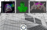 REAL-TIME ADAPTIVITY IN HEAD-AND-NECK AND …on-demand.gputechconf.com/gtc/2015/presentation/S5438-Anand-Sant… · REAL-TIME ADAPTIVITY IN HEAD-AND-NECK AND LUNG CANCER RADIOTHERAPY
