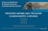 PROSTATE MPMRI AND TRUS/MRI FUSION BIOPSY: A …c.ymcdn.com/sites/ · PROSTATE MPMRI AND TRUS/MRI FUSION BIOPSY: A REVIEW Sam Borofsky, MD ... Djavan B. Virtual prostate biopsy and