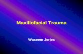 Maxillofacial Trauma - Iraqi Hard Tissue Society · Maxillofacial Trauma Waseem Jerjes. Size of the problem ... Packing and facial bandaging . External carotid ligation (behind ramus,
