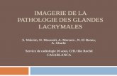 IMAGERIE DE LA PATHOLOGIE DES GLANDES …pe.sfrnet.org/Data/ModuleConsultationPoster/pdf/2013/1/472ef3ba-d... · La pathologie des glandes lacrymales est variée. ... la glande lacrymale