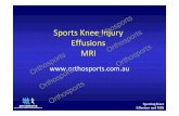 Sports Knee Injury Orthosports Effusions MRI Orthosports€¦ · Effusions MRI Orthosports Orthosports Orthosports Orthosports ... chondromalacia, and quads weakness Orthosports Orthosports