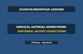 Presentazione di PowerPoint - Lezioni gratuite di … · Cervical arterial dissections: vertebral artery dissections. ... or absence of flow with no spectral Doppler waveform) are