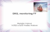 EKG, monitoring FF - zshk.cz · EKG zevní projev aktivity srdce snímá elektrickou aktivitu srdeční slouží k: – detenci poruch srdečního rytmu a frekvence nejčastěji 12