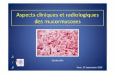 Aspects cliniques et radiologiques des mucormycosesddata.over-blog.com/xxxyyy/2/48/87/07/soireeAIH/mucormycose/... · Aspects cliniques et radiologiques ... – St tSurtout léileucémies